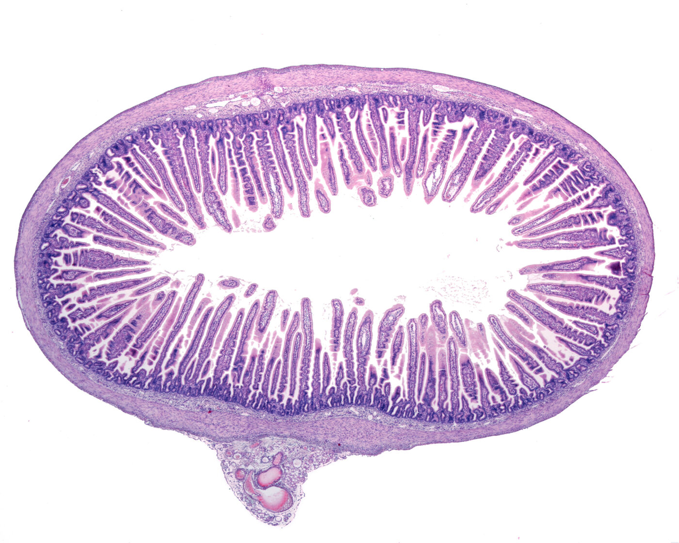 villi